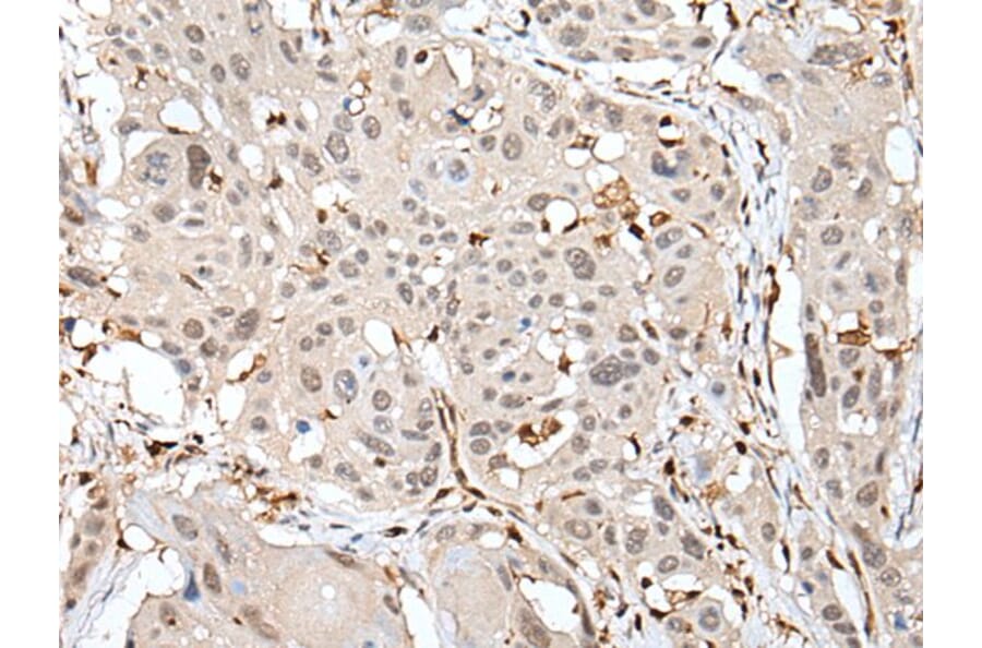 ARHGDIB Antibody from Signalway Antibody (43705) - Antibodies.com