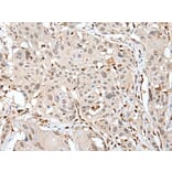 ARHGDIB Antibody from Signalway Antibody (43705) - Antibodies.com