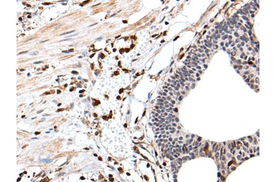 ARHGDIB Antibody from Signalway Antibody (43705) - Antibodies.com