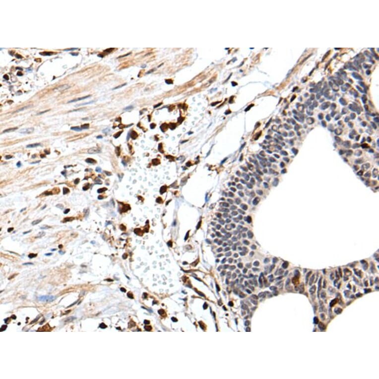 ARHGDIB Antibody from Signalway Antibody (43705) - Antibodies.com