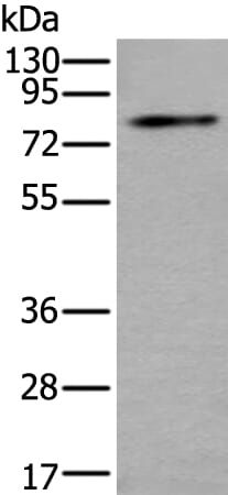 Gel: 8% SDS-PAGE Lysate: 40 &#956;g, Lane: Mouse kidney tissue lysate, Primary antibody: ZDHHC5 antibody at dilution 1/200, Secondary antibody: Goat anti rabbit IgG at 1/8000 dilution, Exposure time: 1 minute