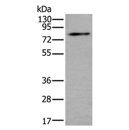 ZDHHC5 Antibody from Signalway Antibody (43785) - Antibodies.com