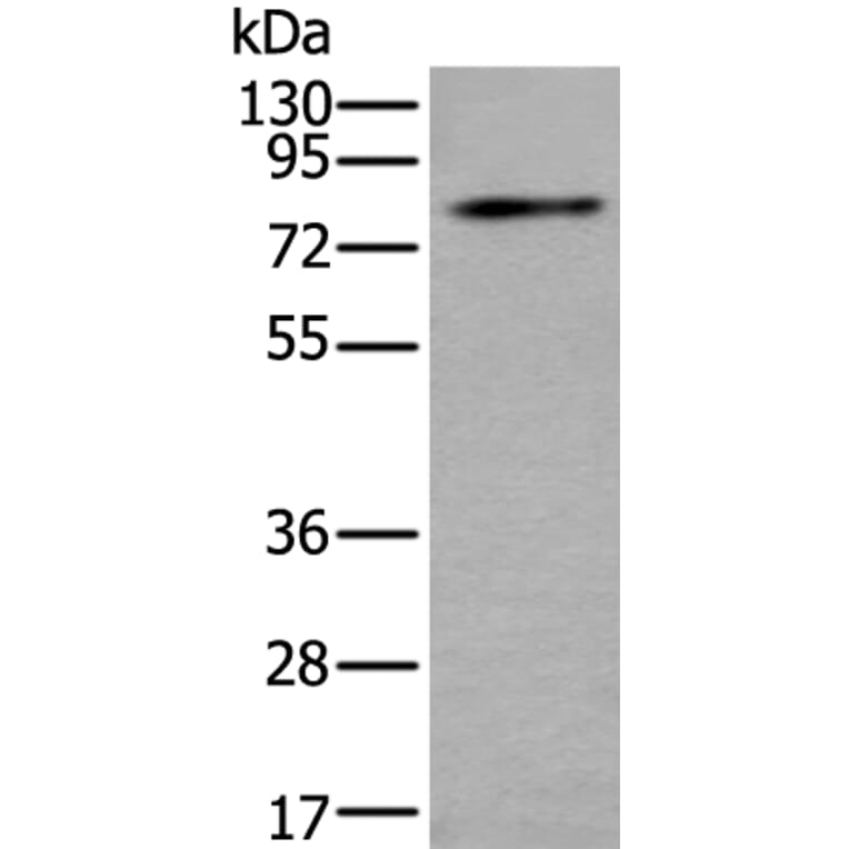 ZDHHC5 Antibody from Signalway Antibody (43785) - Antibodies.com