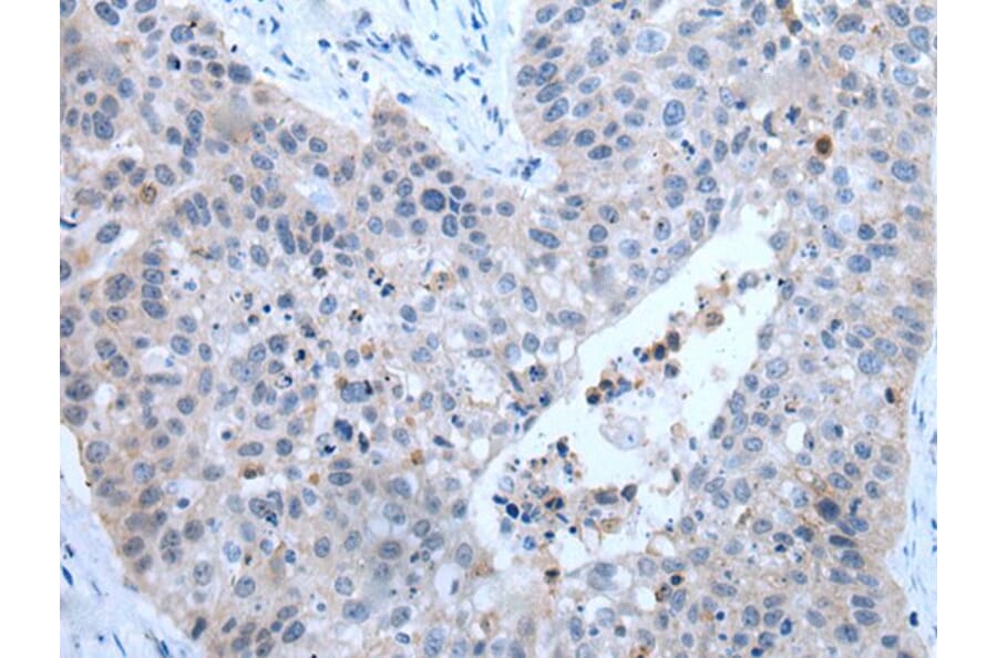 ZDHHC5 Antibody from Signalway Antibody (43785) - Antibodies.com