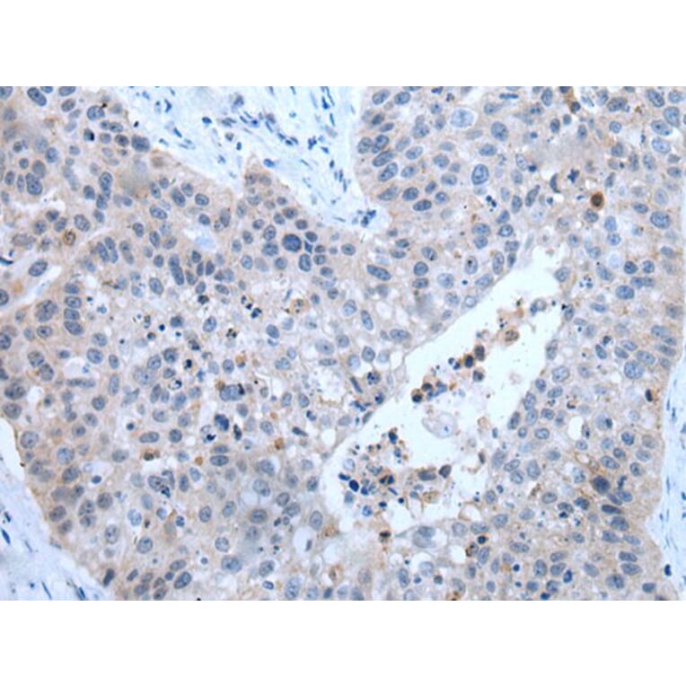 ZDHHC5 Antibody from Signalway Antibody (43785) - Antibodies.com