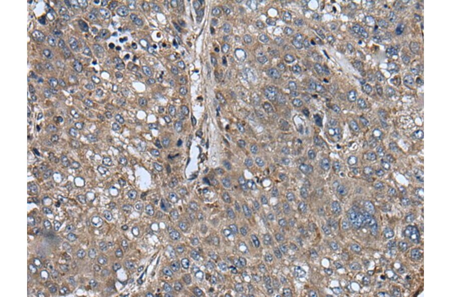 ARFGEF1 Antibody from Signalway Antibody (43848) - Antibodies.com