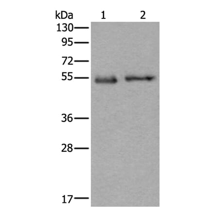 SLC38A1 Antibody from Signalway Antibody (43909) - Antibodies.com