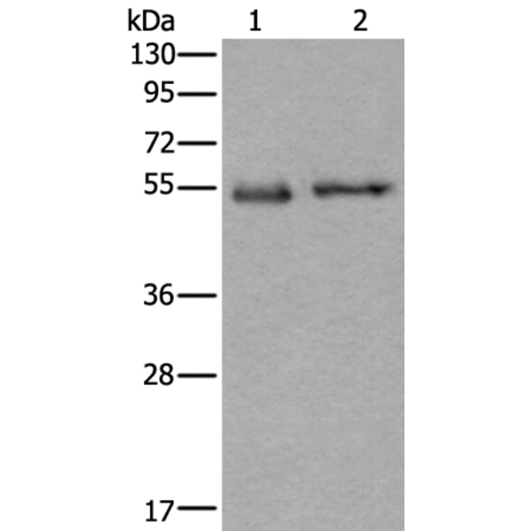 SLC38A1 Antibody from Signalway Antibody (43909) - Antibodies.com