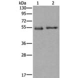 SLC38A1 Antibody from Signalway Antibody (43909) - Antibodies.com