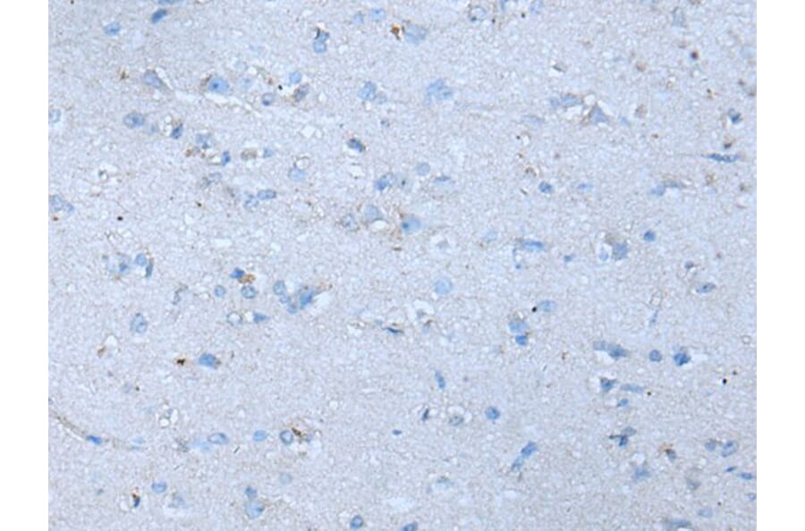 SLC38A1 Antibody from Signalway Antibody (43909) - Antibodies.com