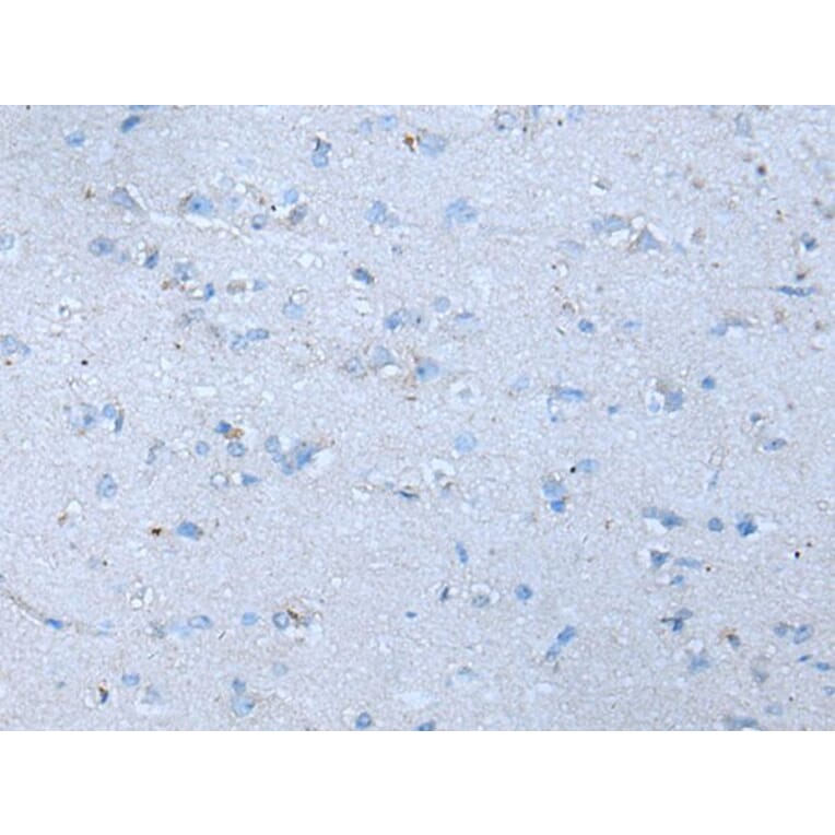 SLC38A1 Antibody from Signalway Antibody (43909) - Antibodies.com