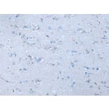 SLC38A1 Antibody from Signalway Antibody (43909) - Antibodies.com