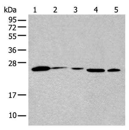 BHLHA15 Antibody from Signalway Antibody (43992) - Antibodies.com