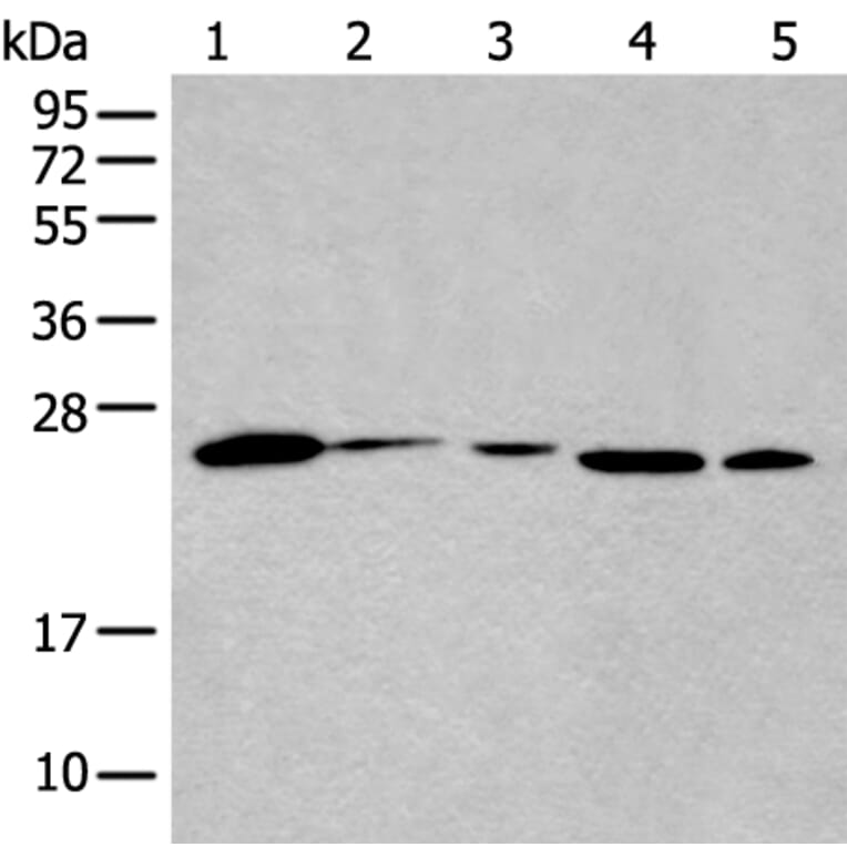 BHLHA15 Antibody from Signalway Antibody (43992) - Antibodies.com