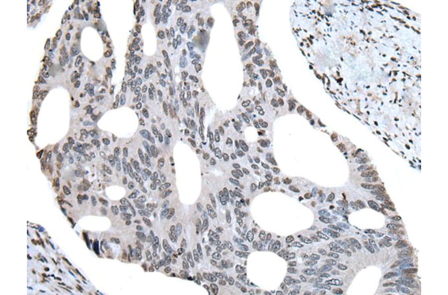 BHLHA15 Antibody from Signalway Antibody (43992) - Antibodies.com