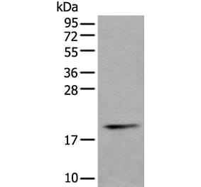 PTP4A1 Antibody from Signalway Antibody (43526) - Antibodies.com