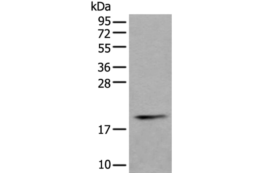 PTP4A1 Antibody from Signalway Antibody (43526) - Antibodies.com