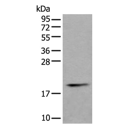 PTP4A1 Antibody from Signalway Antibody (43526) - Antibodies.com