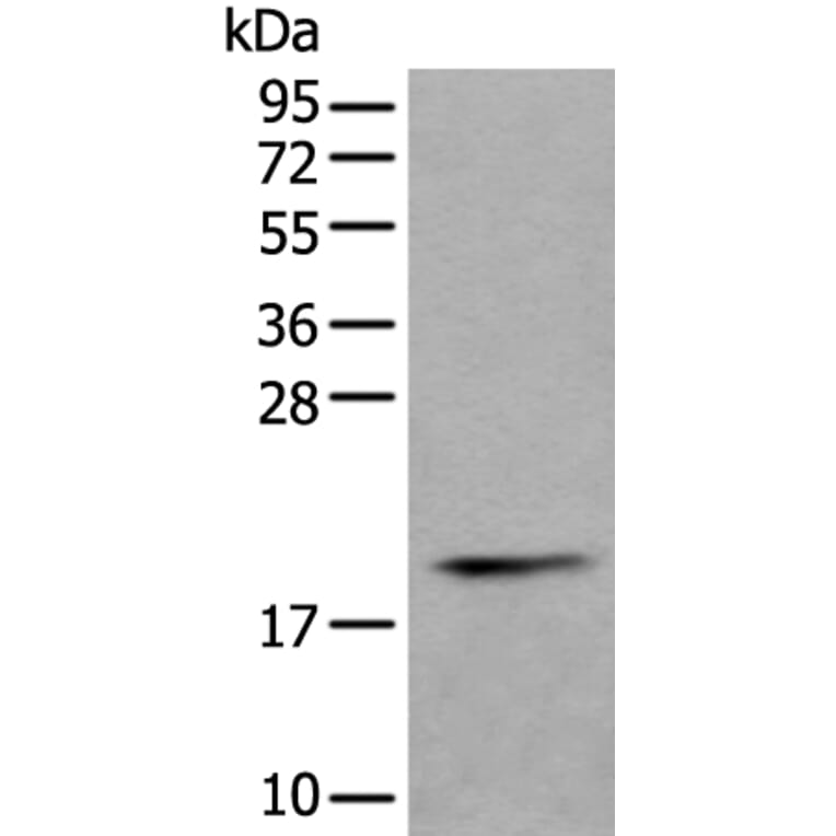 PTP4A1 Antibody from Signalway Antibody (43526) - Antibodies.com