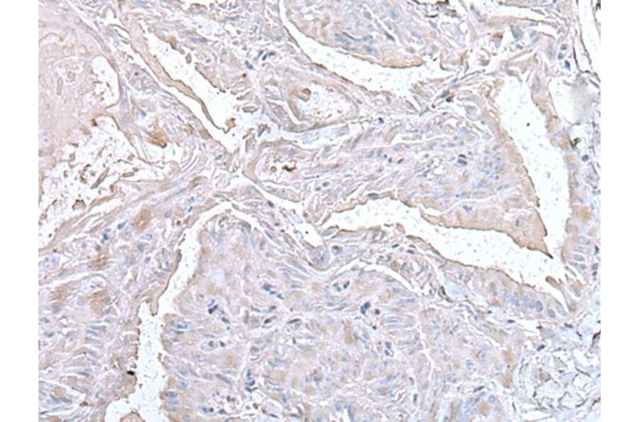 PTP4A1 Antibody from Signalway Antibody (43526) - Antibodies.com