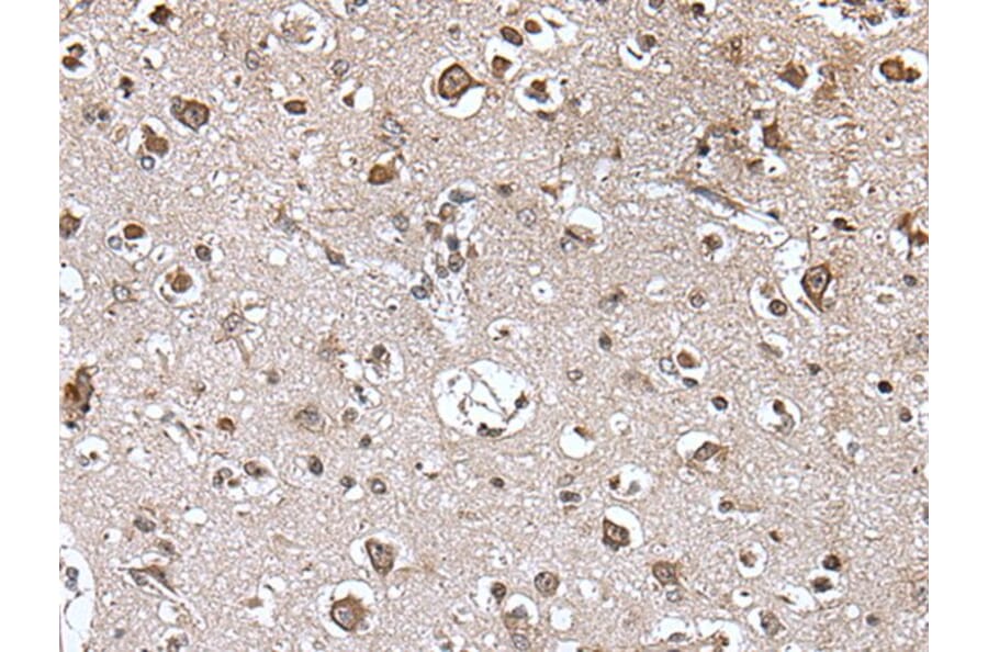 TRIM27 Antibody from Signalway Antibody (43542) - Antibodies.com