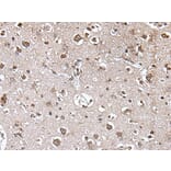 TRIM27 Antibody from Signalway Antibody (43542) - Antibodies.com