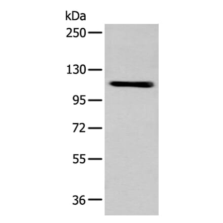 ZNF281 Antibody from Signalway Antibody (43566) - Antibodies.com