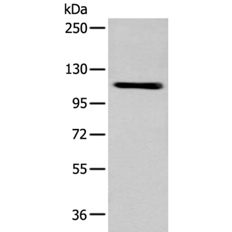 ZNF281 Antibody from Signalway Antibody (43566) - Antibodies.com