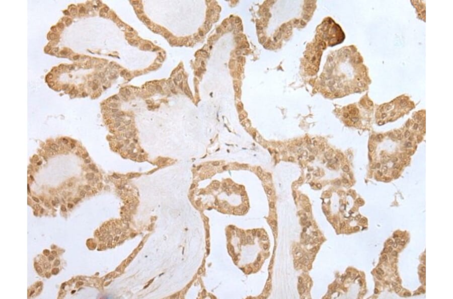 ZNF281 Antibody from Signalway Antibody (43566) - Antibodies.com