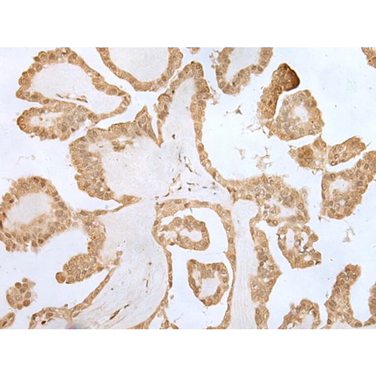 ZNF281 Antibody from Signalway Antibody (43566) - Antibodies.com