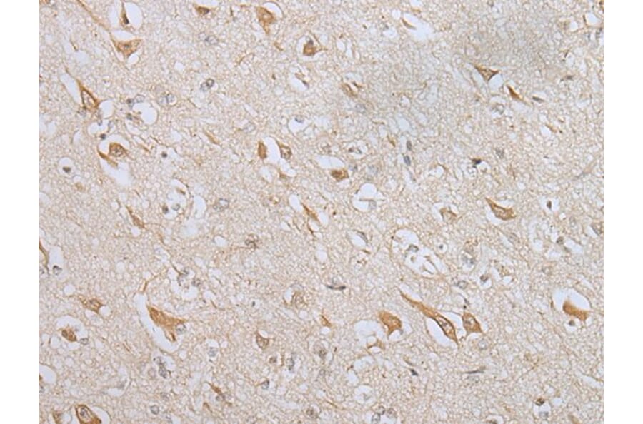 ZNF281 Antibody from Signalway Antibody (43566) - Antibodies.com