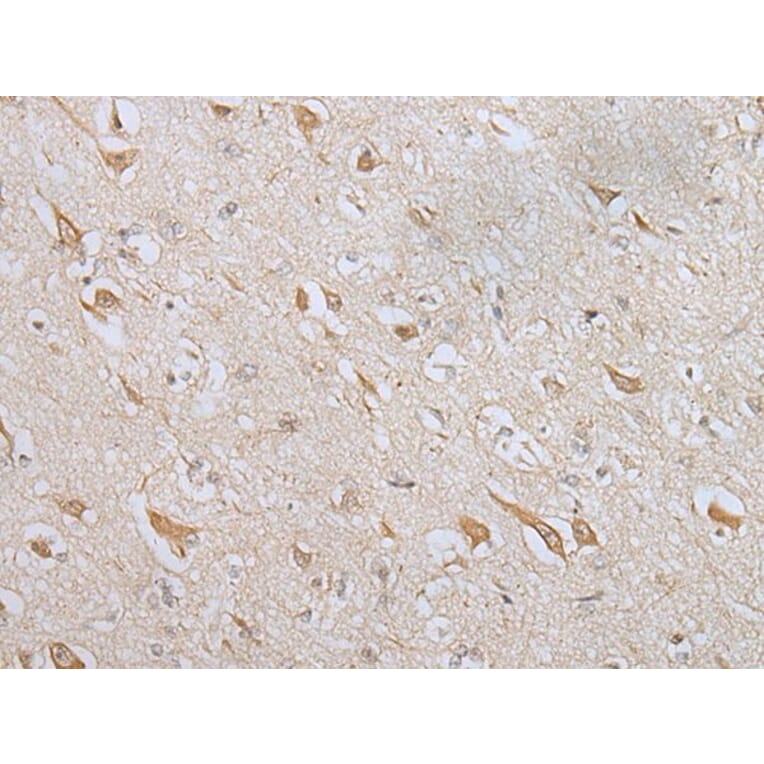 ZNF281 Antibody from Signalway Antibody (43566) - Antibodies.com