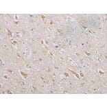 ZNF281 Antibody from Signalway Antibody (43566) - Antibodies.com