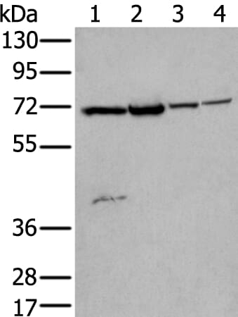 Gel: 6%SDS-PAGE Lysate: 40 &#956;g, Lane 1-4: Hela and Jurkat cell lysates£¬Rat brain tissue and Human testis tissue lysates, Primary antibody: ZNF131 antibody at dilution 1/200, Secondary antibody: Goat anti rabbit IgG at 1/8000 dilution, Exposure time: 15 seconds