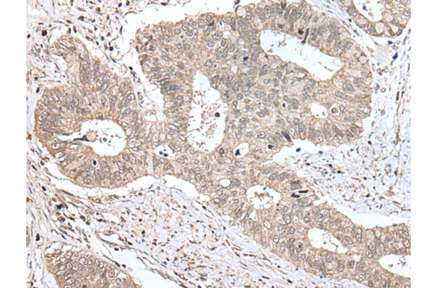 ZNF131 Antibody from Signalway Antibody (43572) - Antibodies.com