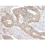 ZNF131 Antibody from Signalway Antibody (43572) - Antibodies.com