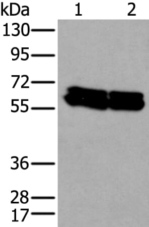 Gel: 8% SDS-PAGE Lysate: 40 &#956;g, Lane 1-2: HEPG2 and Hela cell lysates, Primary antibody: ZNF207 antibody at dilution 1/300, Secondary antibody: Goat anti rabbit IgG at 1/8000 dilution, Exposure time: 10 seconds