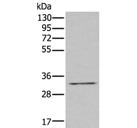 ZNF346 Antibody from Signalway Antibody (43579) - Antibodies.com
