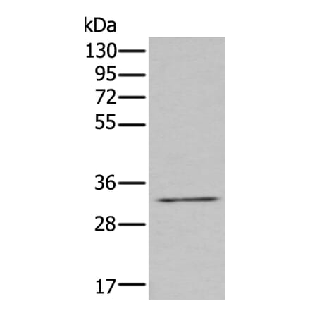 ZNF346 Antibody from Signalway Antibody (43579) - Antibodies.com