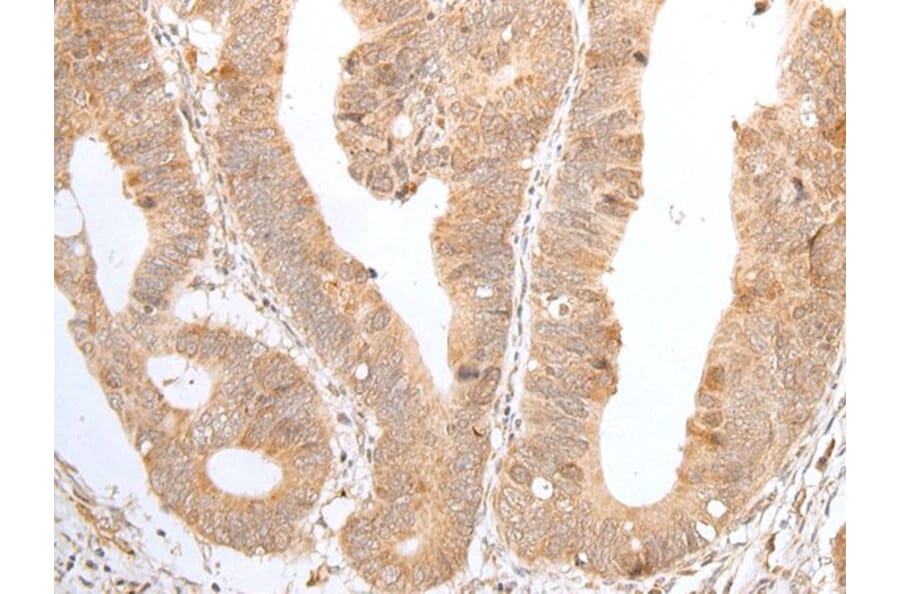 ZNF346 Antibody from Signalway Antibody (43579) - Antibodies.com