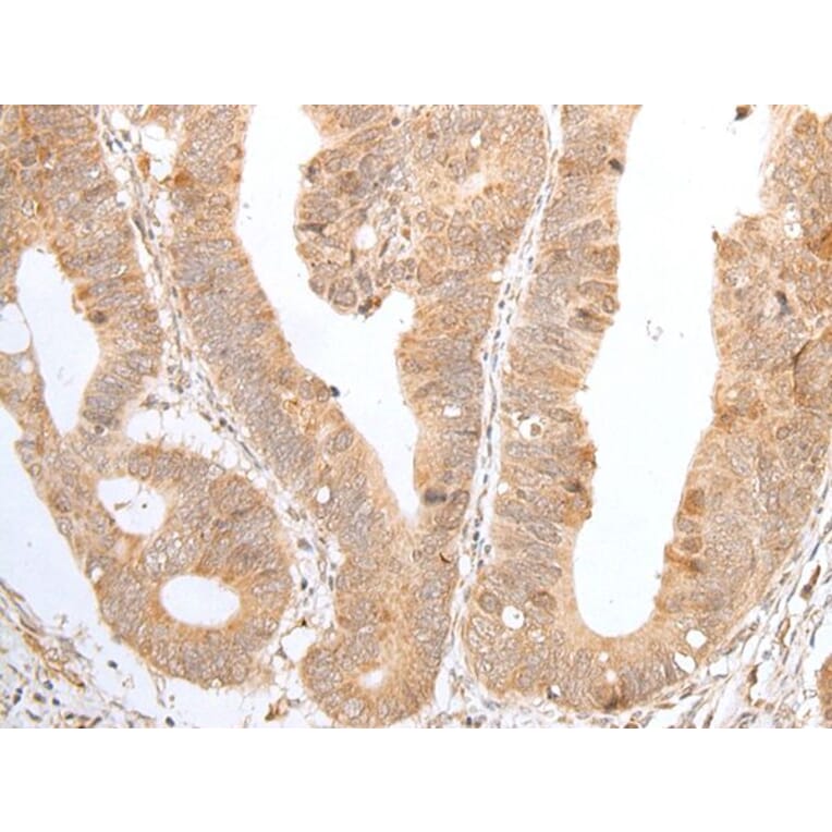 ZNF346 Antibody from Signalway Antibody (43579) - Antibodies.com