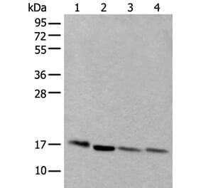 UBE2D3 Antibody from Signalway Antibody (43602) - Antibodies.com