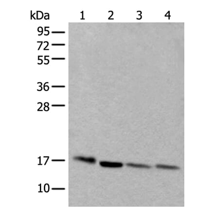 UBE2D3 Antibody from Signalway Antibody (43602) - Antibodies.com