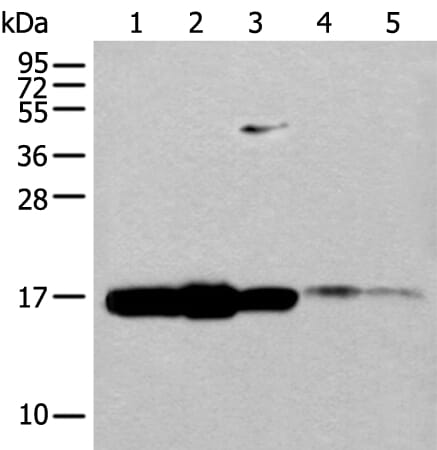Gel: 12% SDS-PAGE Lysate: 40 &#956;g, Lane 1-5: HT-29 cell, Human fetal brain tissue,293T cell, Mouse spleen tissue and Human spleen tissue lysates, Primary antibody: UBE2V1 antibody at dilution 1/400, Secondary antibody: Goat anti rabbit IgG at 1/8000 dilution, Exposure time: 1 minute