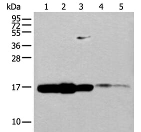 UBE2V1 Antibody from Signalway Antibody (43603) - Antibodies.com