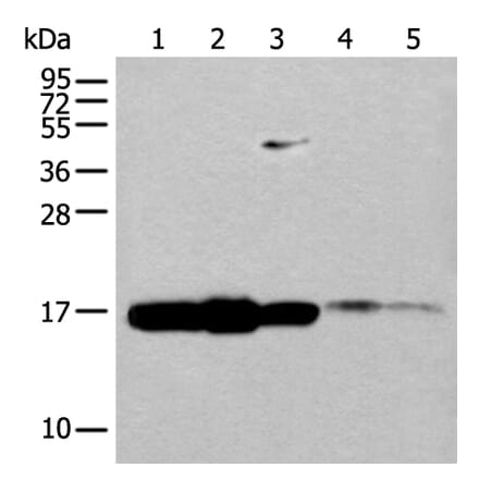 UBE2V1 Antibody from Signalway Antibody (43603) - Antibodies.com