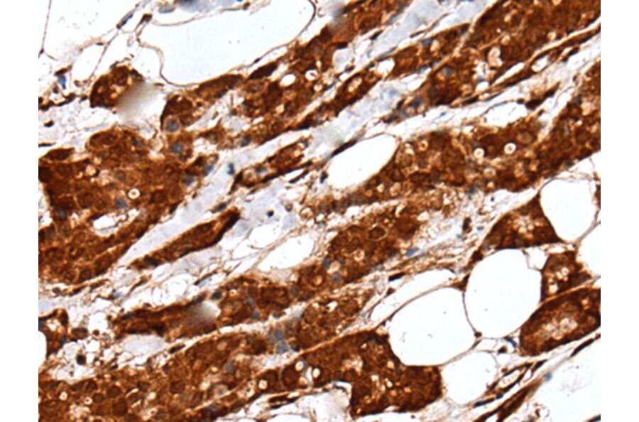 UBE2V1 Antibody from Signalway Antibody (43603) - Antibodies.com