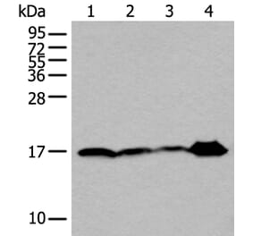 UBE2V2 Antibody from Signalway Antibody (43607) - Antibodies.com