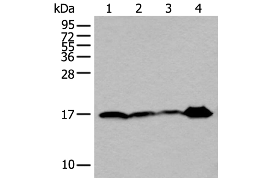 UBE2V2 Antibody from Signalway Antibody (43607) - Antibodies.com
