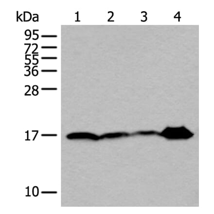 UBE2V2 Antibody from Signalway Antibody (43607) - Antibodies.com